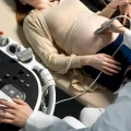 Imagem ilustrativa de médica ginecologista fazendo exame de ultrassom em paciente gestante para diagnosticar a megabexiga fetal.
