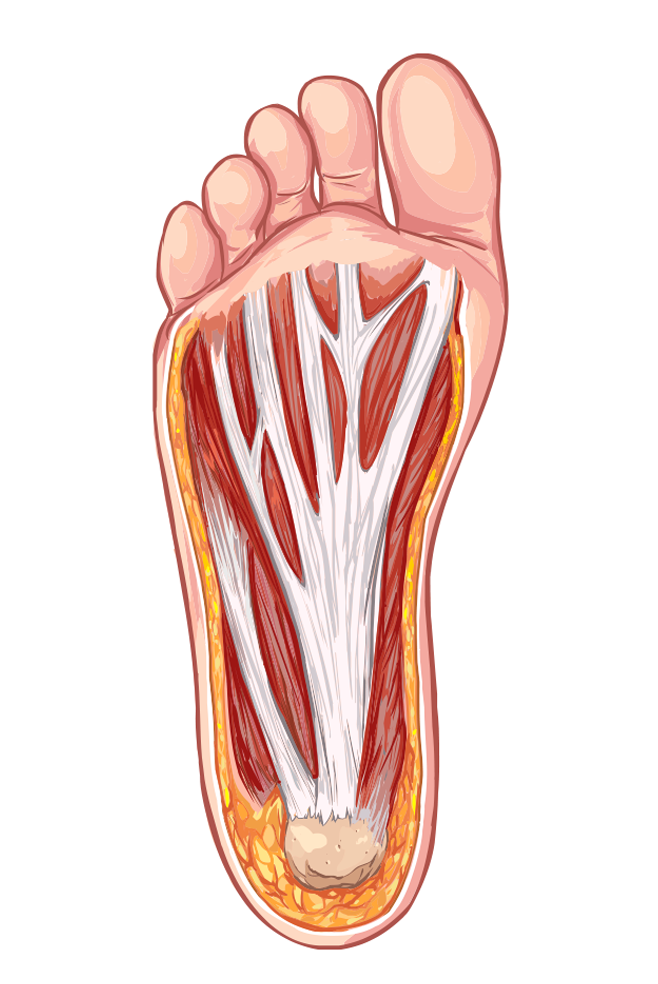 Ilustração mostrando a fascia do pé