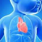 Cardiopatias congênitas e comprometimento do neurodesenvolvimento: qual a relação?