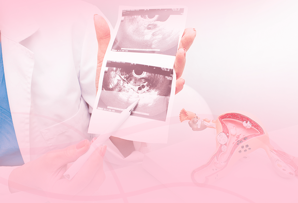 Histerossalpingografia