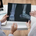 Ortopedista com pós-graduação analisa exame de imagem de ressonância magnética no pé