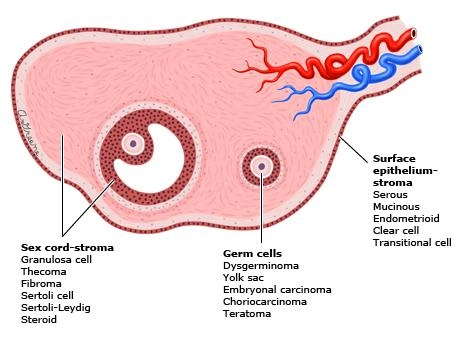 Imagem ilustrativa sobre as origens dos tumores ovarianos.