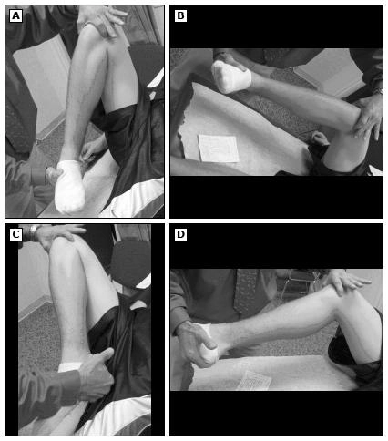 Imagem para demonstrar como é feito o Teste de McMurray na avaliação de lesão na cartilagem do joelho.
