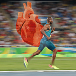 Reabilitação cardíaca em atletas: como conduzir o tratamento?