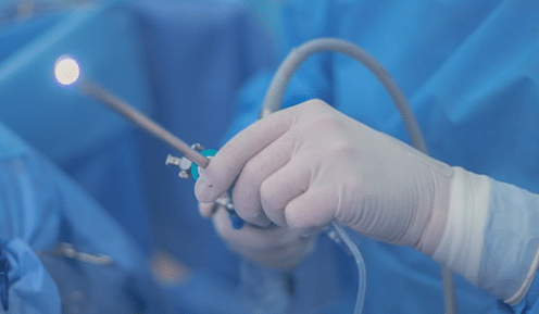 histeroscopia diagn&oacute;stica