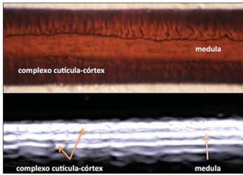Comparação entre microscopia óptica e ultrassonografia de um fio de cabelo, mostrando o complexo cutícula-córtex e a medula capilar.
