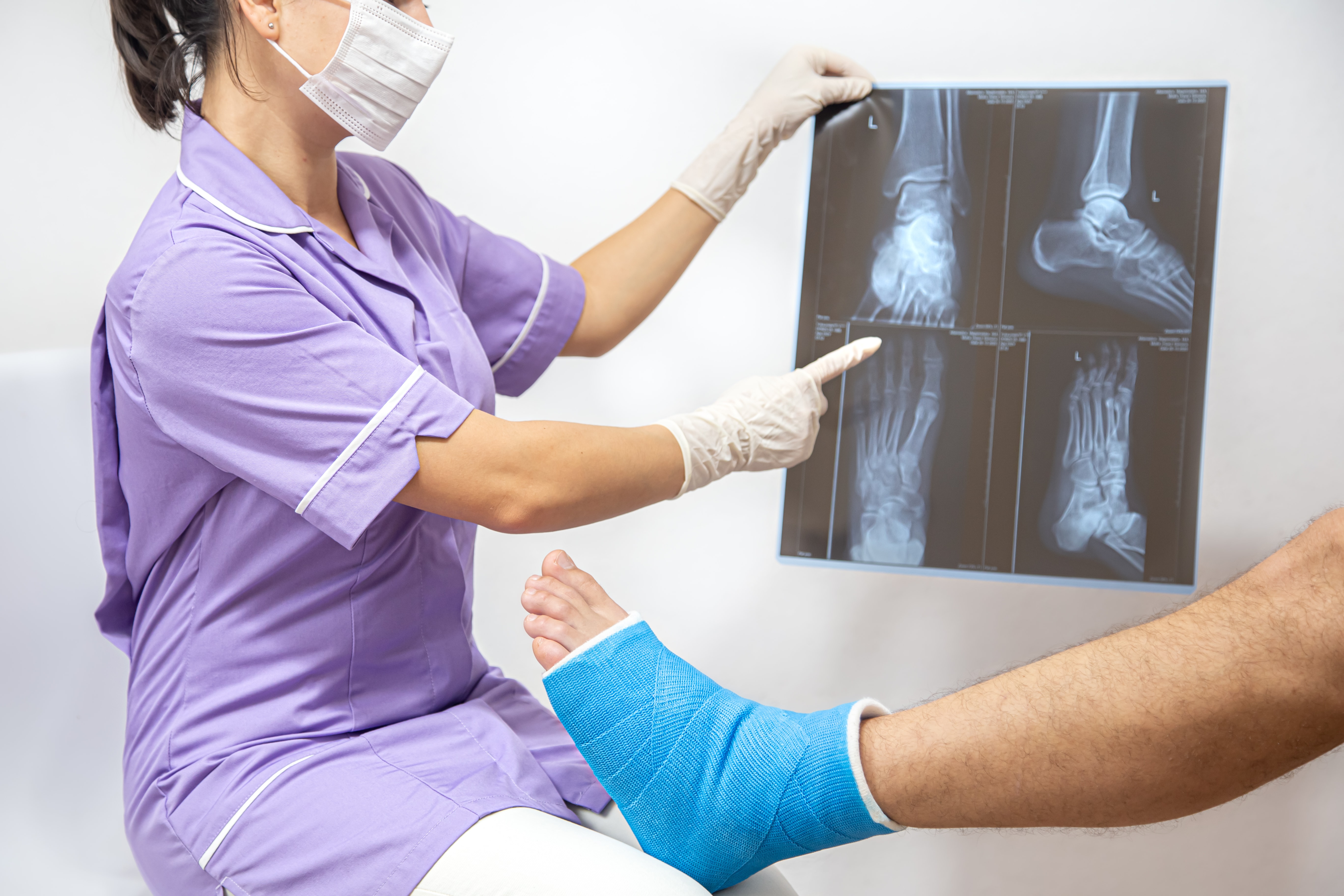 Profissional da sa&uacute;de analisa radiografia de p&eacute; com paciente engessado, em avalia&ccedil;&atilde;o pr&eacute; ou p&oacute;s-operat&oacute;ria de osteotomia.