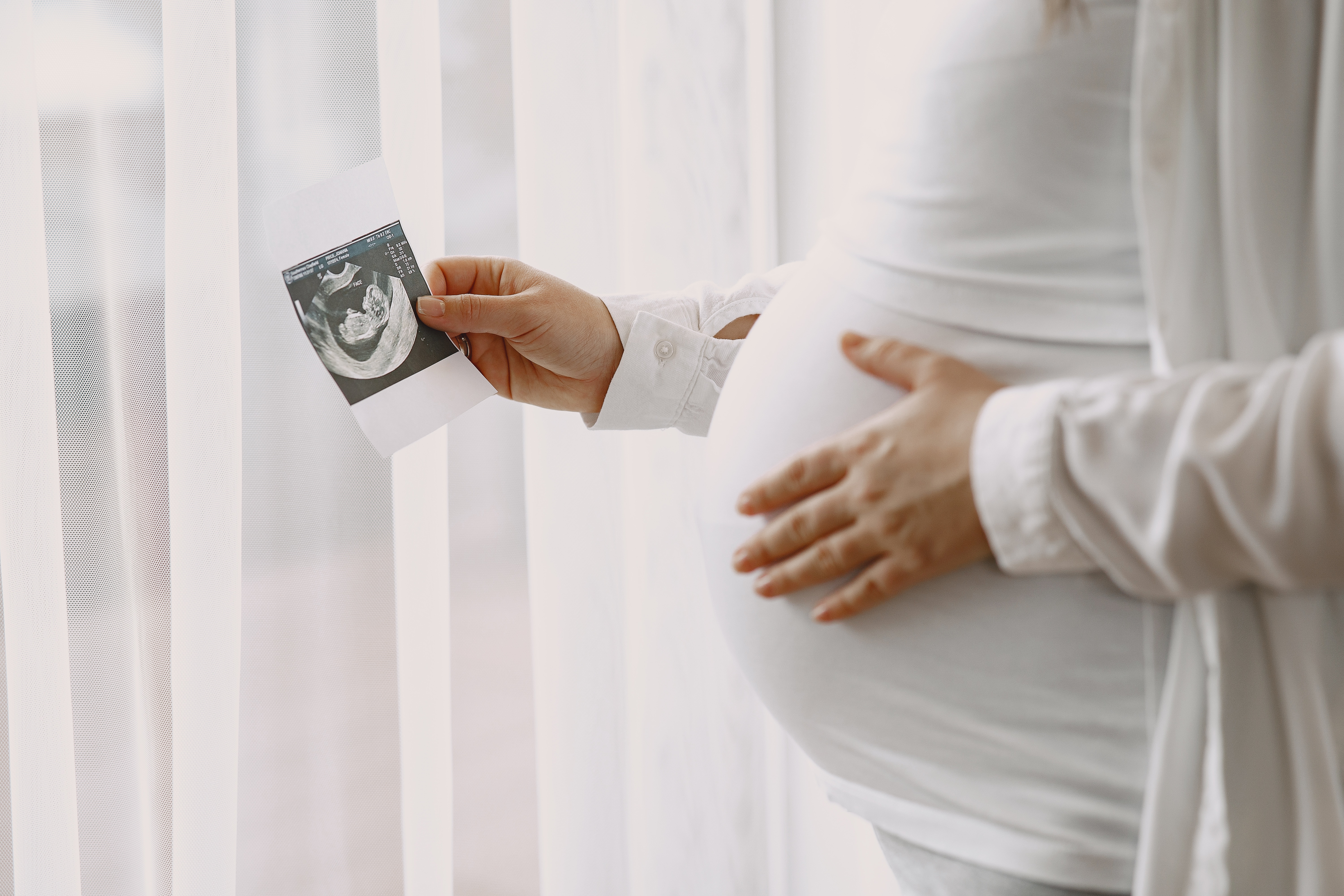 Mulher gr&aacute;vida em p&eacute; pr&oacute;xima a uma janela com cortina branca, segurando uma imagem de ultrassonografia fetal com uma m&atilde;o e apoiando a barriga com a outra.