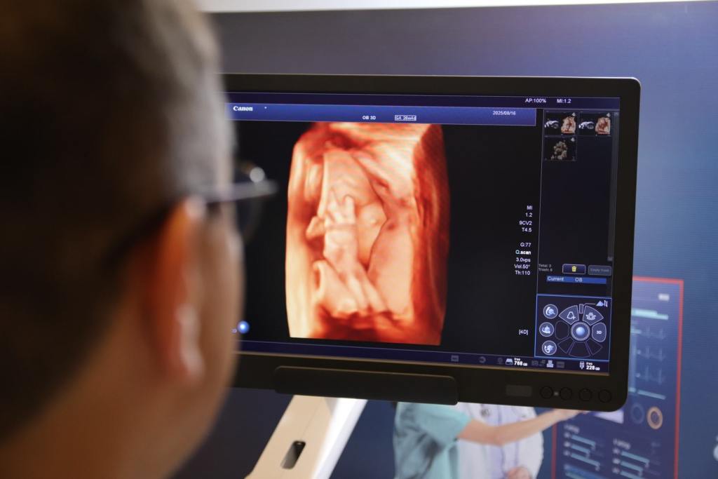 Imagem de ultrassonografia 3D de um feto em tela, visualizada por um profissional de sa&uacute;de.