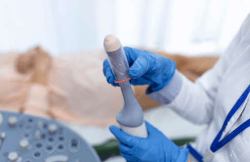 A imagem mostra um profissional da sa&uacute;de segurando um transdutor de ultrassom endovaginal, coberto por uma prote&ccedil;&atilde;o (geralmente um preservativo ou capa espec&iacute;fica para uso m&eacute;dico), provavelmente antes de realizar um exame de ultrassonografia transvaginal.