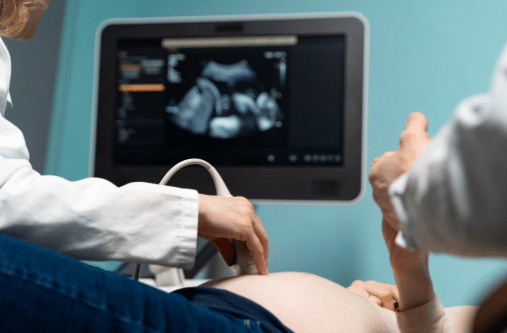 Ultrassonografia morfol&oacute;gica mostrando a barriga de gestante com o aparelho de ultrassom sobre o abd&ocirc;men, imagem do feto vis&iacute;vel no monitor do equipamento.