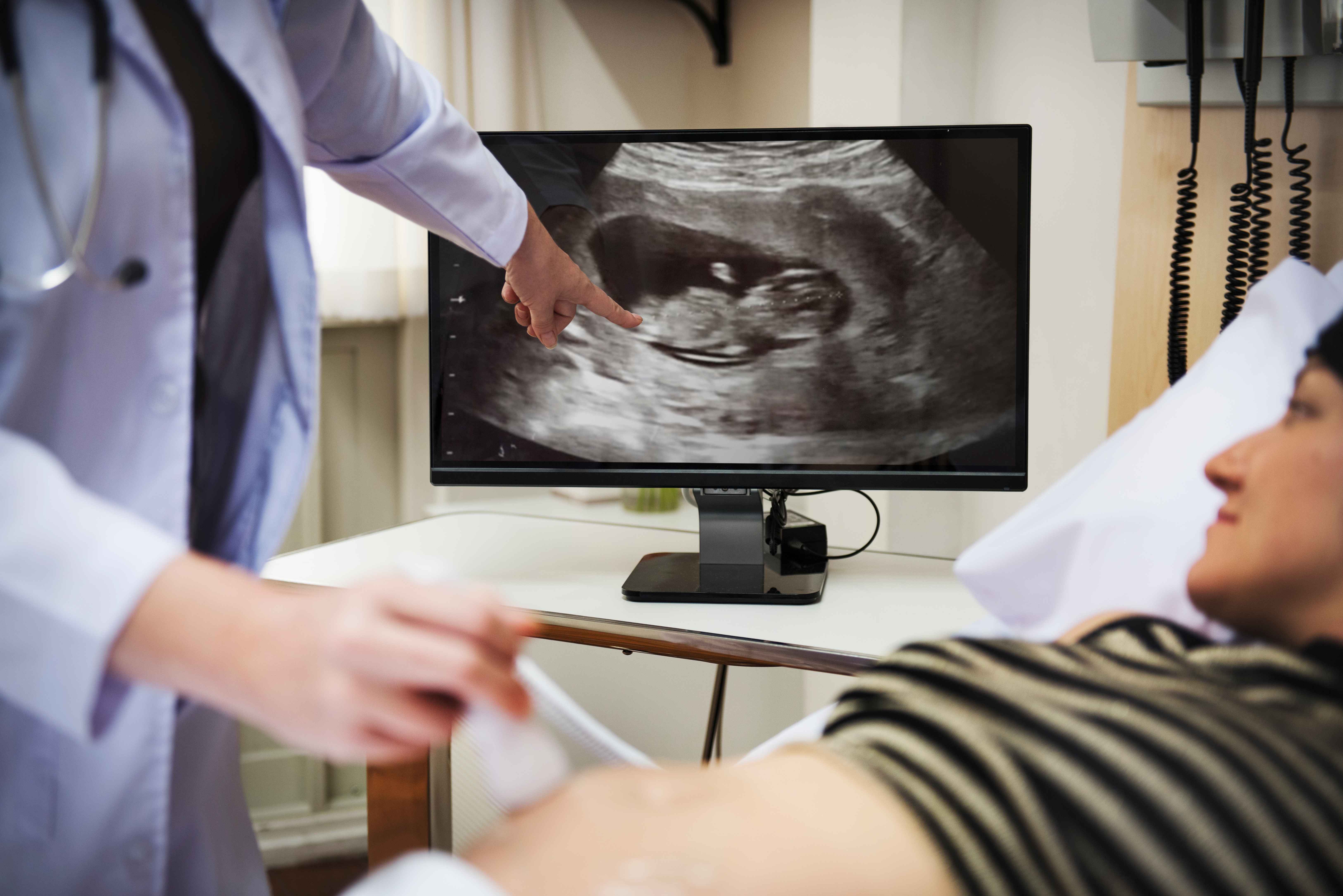 M&eacute;dico realizando exame de ultrassom obst&eacute;trico enquanto mostra a imagem do feto no monitor para uma gestante durante consulta pr&eacute;-natal.