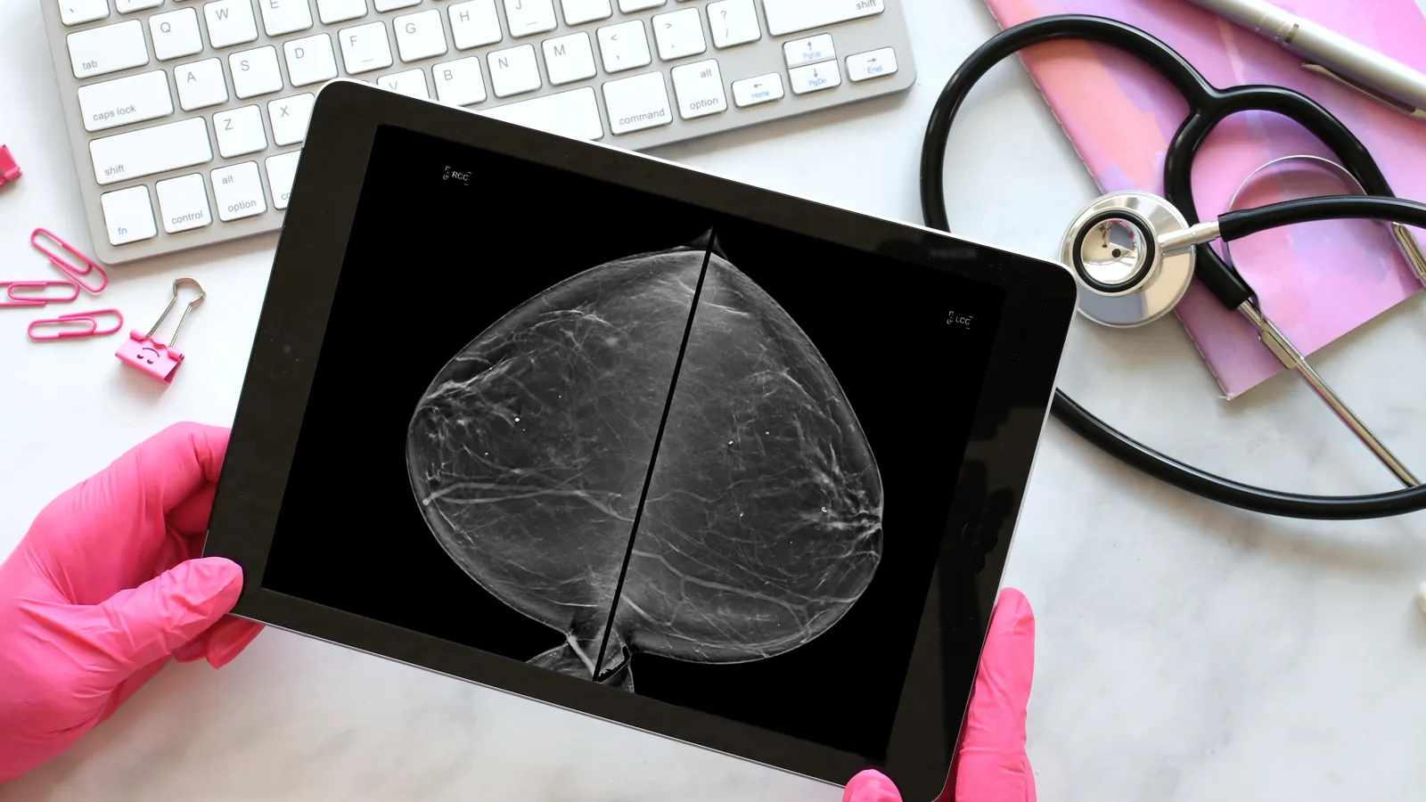 Mamografia em tablet: atualização em diagnóstico da mama