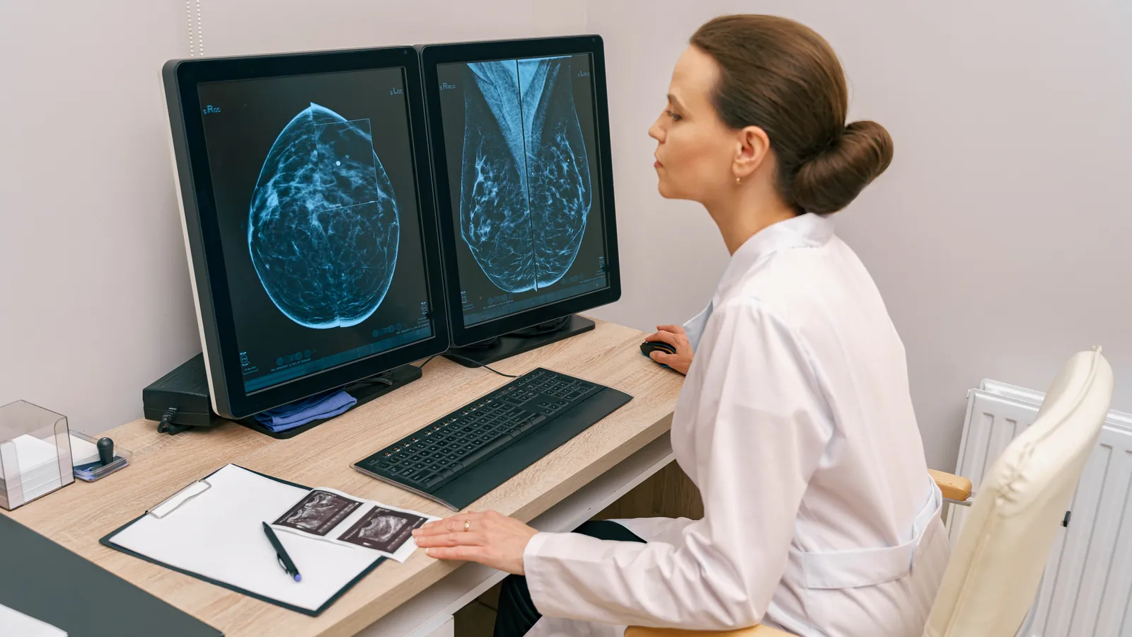 Radiologista analisa imagens de mamografia em dois monitores para classificação BI-RADS